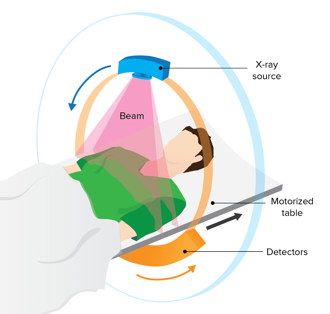 6-5-1e- CAT scan machine diagram.png