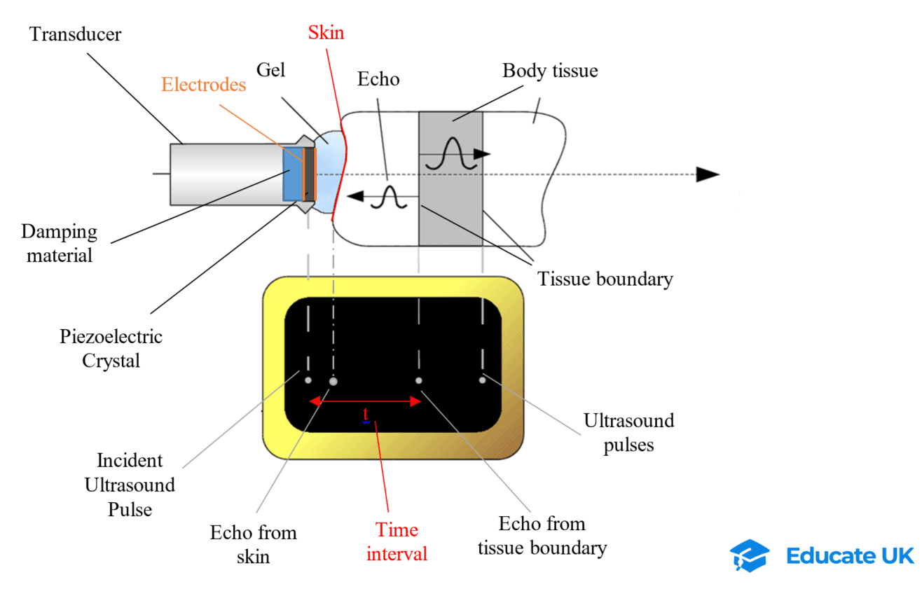 6-5-3b- Ultrasound transducer.png